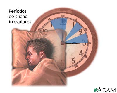 Ilustración sobre el sueño irregular