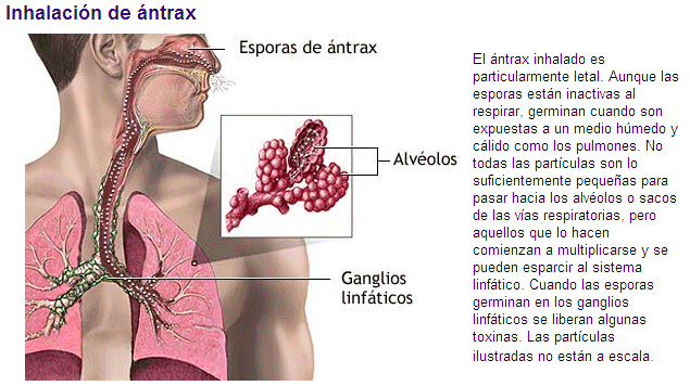 Explicacíon sobre el Antrax