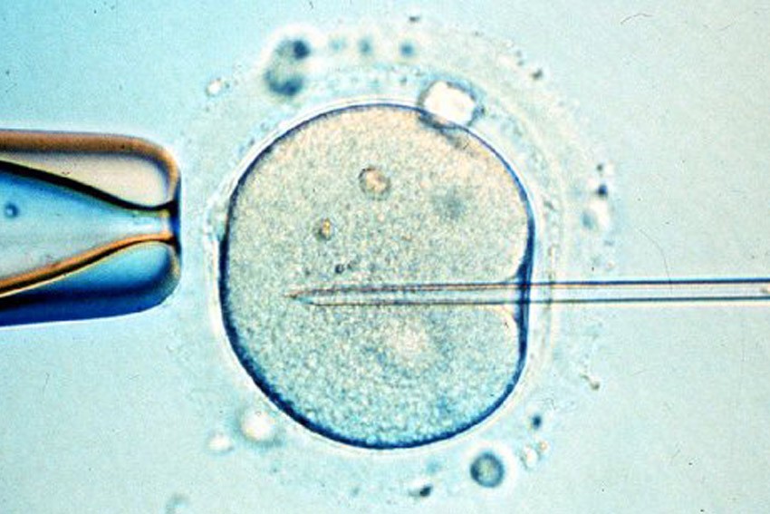 Fecundación in vitro