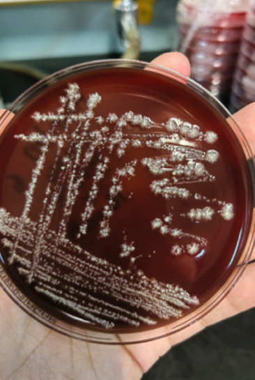      Estas fueron las bacterias encontradas  Staphylococcus epidermidis Staphylococcus sciuri …