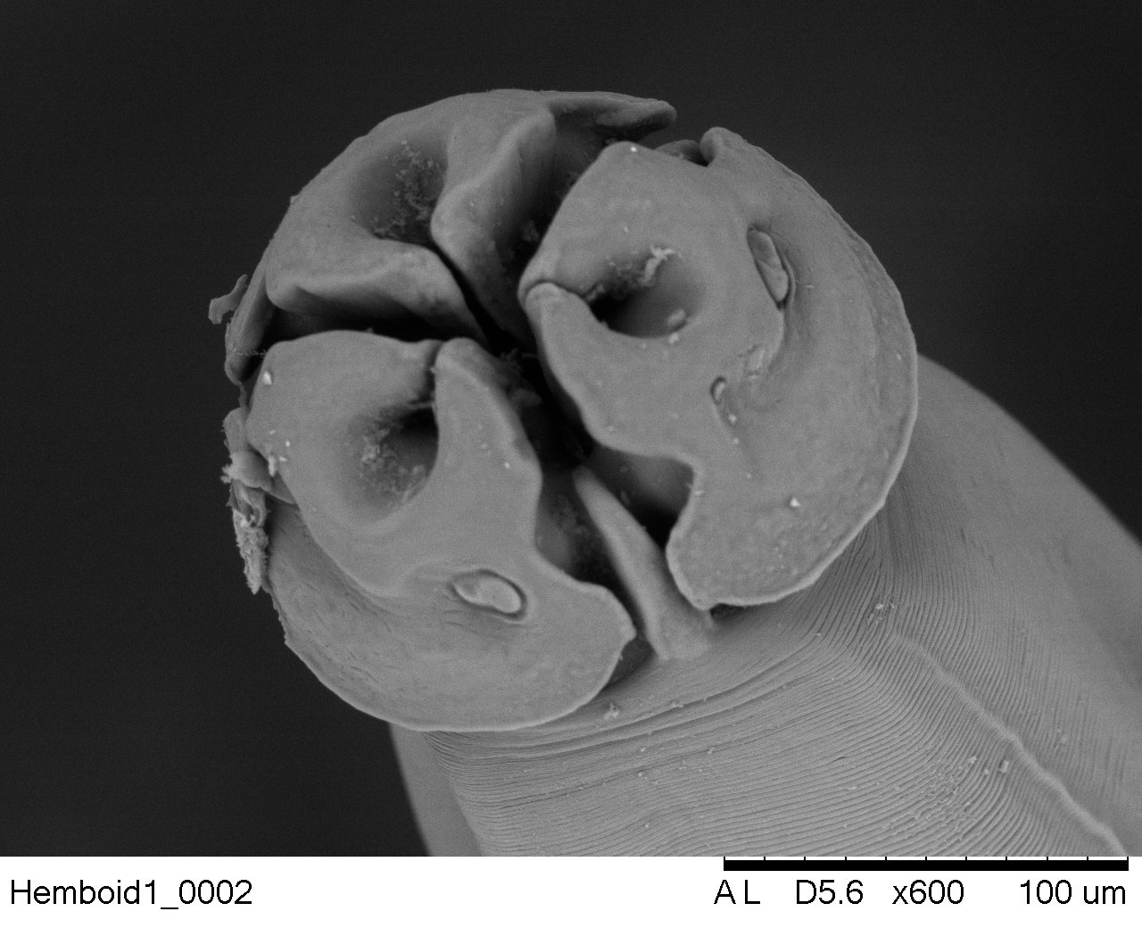 Parásito visto desde microscopía electrónica
