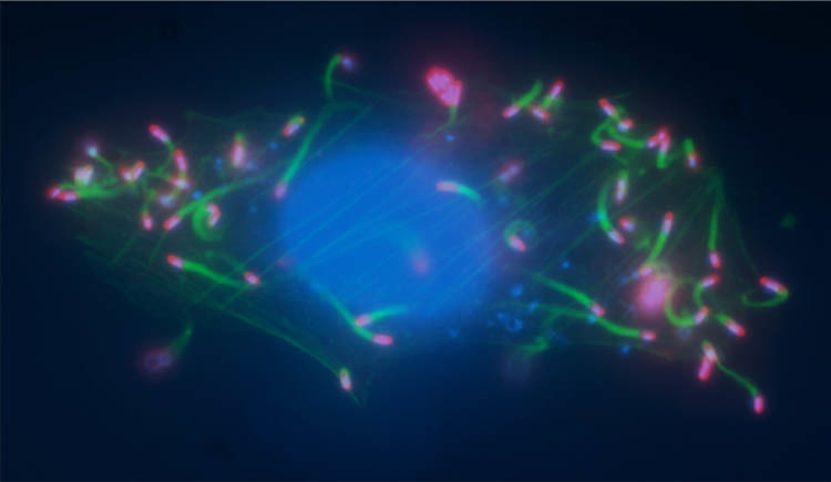 En esta imagen tomada mediante la técnica de microscopía de fluorescencia se observa cómo las …