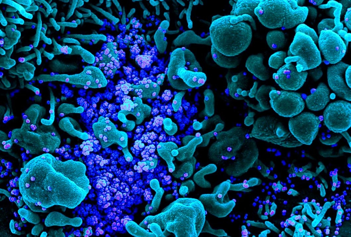 Imagen microscópica de virus