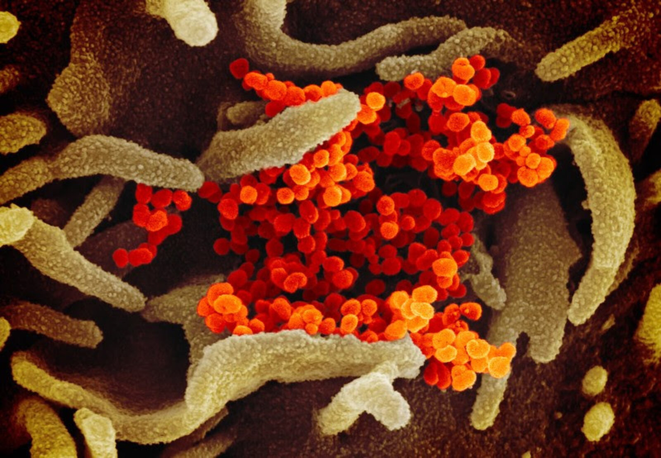 La espícula del virus tiene casi 1 300 aminoácidos, para los cuales hay mutaciones en 32. No …