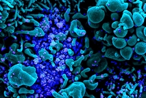 Imagen microscópica de virus