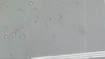 Es fácil distinguir a la Naegleria fowleri, porque es el único microorganismo de forma irregular …
